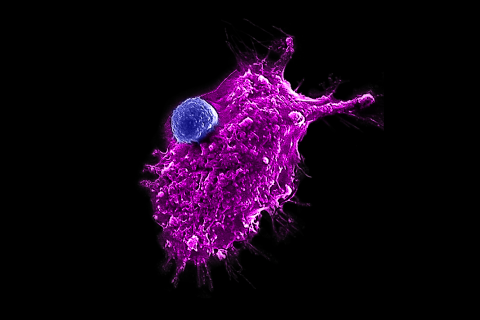 Campaign cover for Support Dr. Caspian Oliai and Dr. Lili Yang's Research