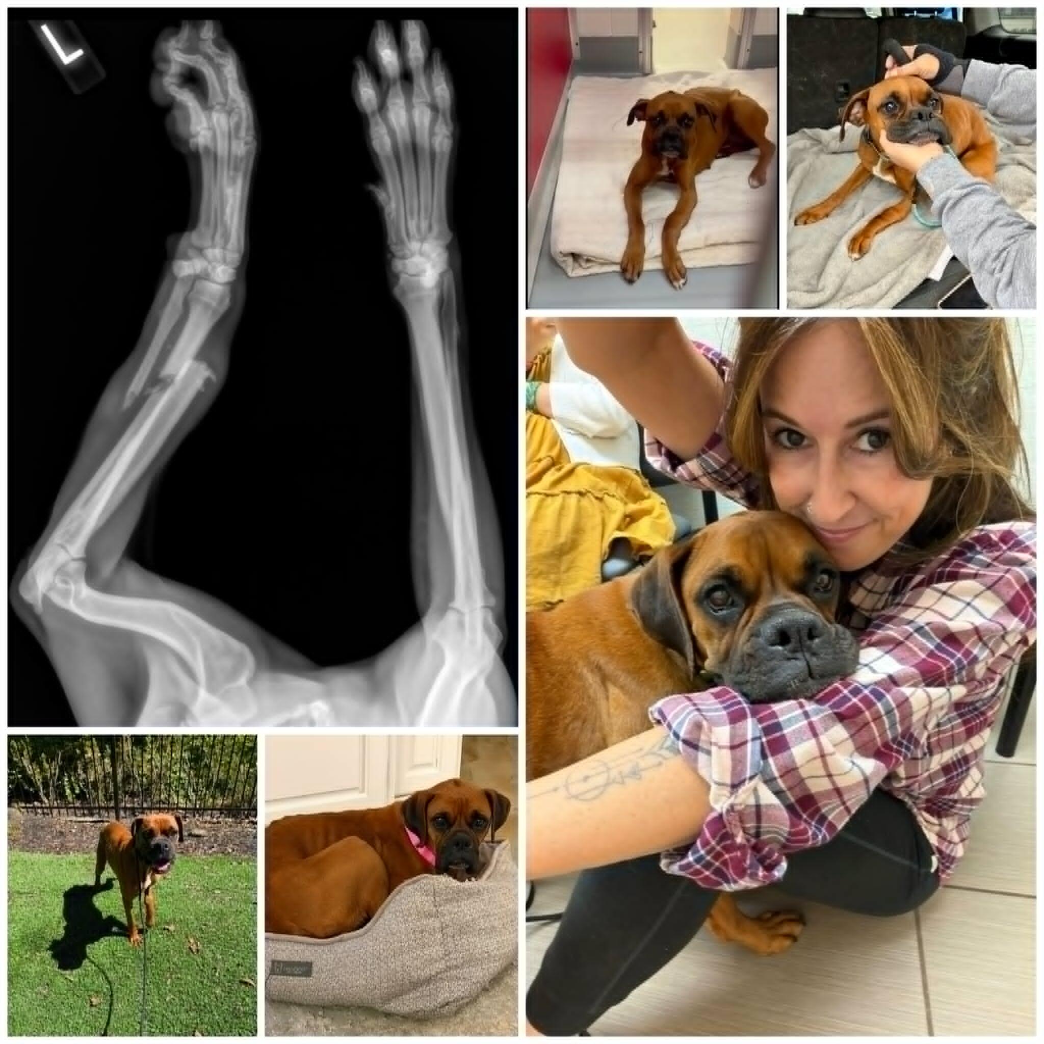 Campaign cover image for Mariposa's Amputation Surgery