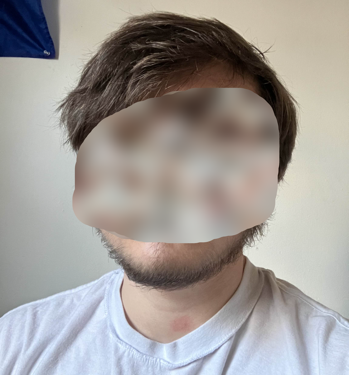 Campaign cover image for Rescue Fund for a Disabled Trans Youth in Crisis