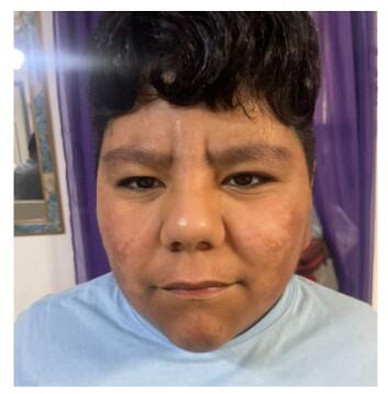 Campaign cover for Sponsor Josue's Hearing Journey