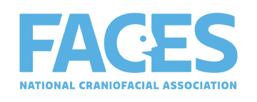 FACES THE NATIONAL CRANIOFACIAL ASSOCIATION