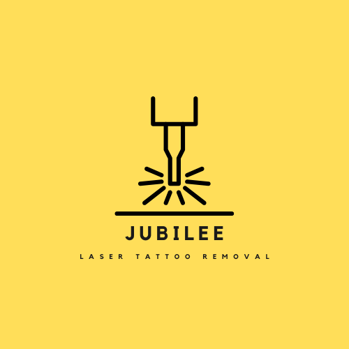 Jubilee Tattoo Removal